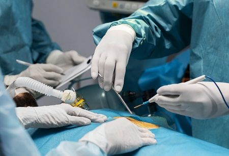  kidney transplant